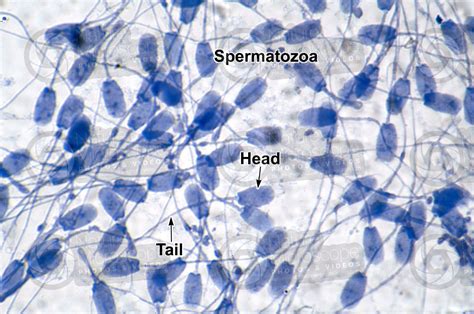 Man Spermatozoon 1000x Man Mammals Reproductive System Other