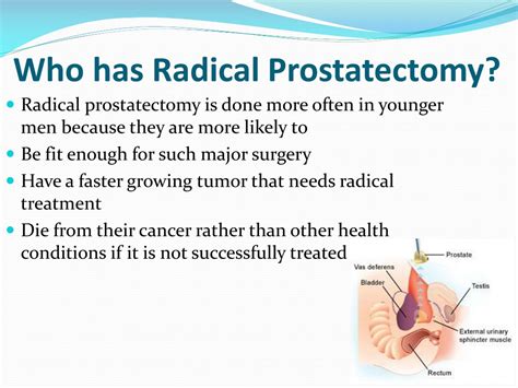 Ppt Radical Prostatectomy Surgery India Powerpoint Presentation Free Download Id