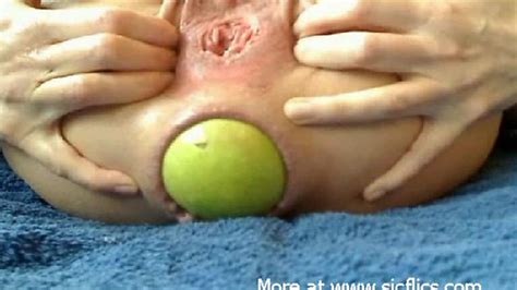 Sicflics Extreme Anal Stretching And Insertions Porn Videos