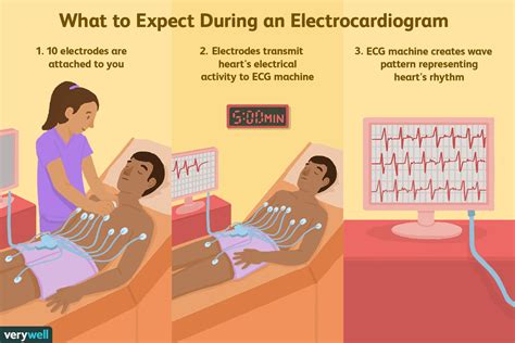 Electrocardiogram Ekg Or Ecg Procedure And Results