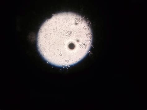 Could This Be A Mycoplasma In Cell Culture And What The Other Picture