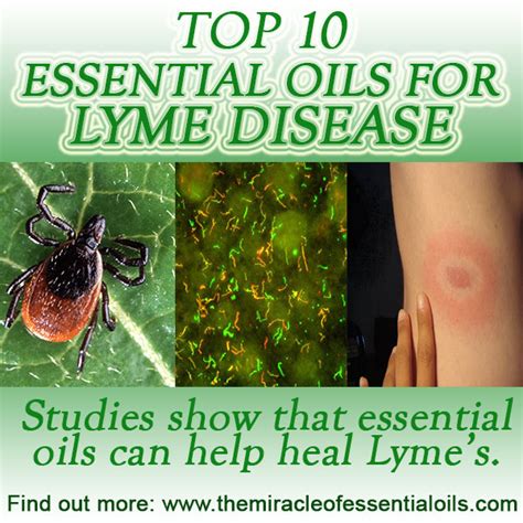 10 Essential Oils For Lyme Disease And Recipes To Use The Miracle Of
