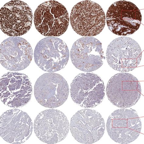 Representative Micrographs Of P16 Ink4a Expression Patterns In Primary