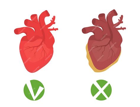 Premium Vector Healthy Heart And Unhealthy Heart Fatty Infographics