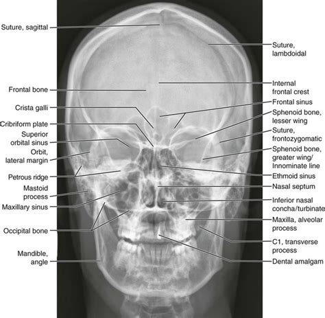 normal anatomy radiology key