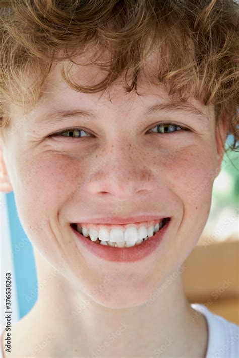 Close Up Portrait Of Redhead Smiling Boy With Freckles Teen Boy Has