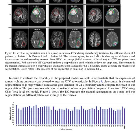 Dice Coefficient Comparison Between The Main Ctv On P Map And Chan Vese