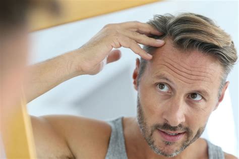 Middle Aged Man Concerned By Hair Loss The Hair Connection