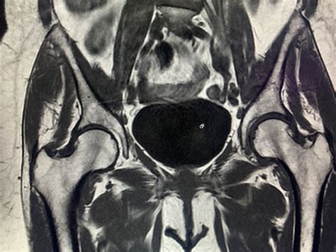 Il dispose d'un centre dédié à l'irm, situé au 192 boulevard haussmann, à proximité immédiate du centre principal. IRM au centre de radiologie AB Marcadet Clignancourt ...
