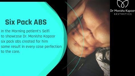 Six Pack Abs Surgery In Delhi 4d High Definition Surgery Youtube