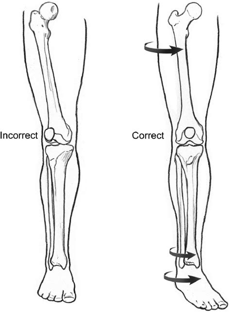 Treatment Strategy For Malunion Musculoskeletal Key