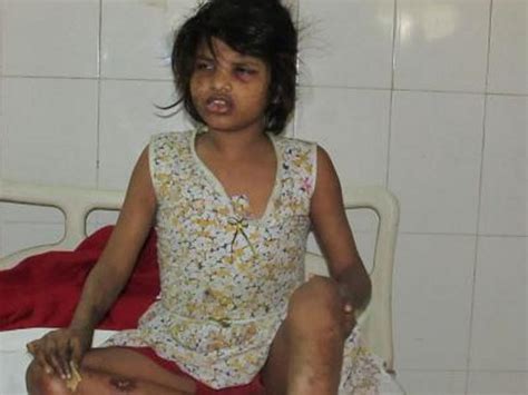 В Индии найдена одичавшая девочка Маугли которая жила среди обезьян Загадки человека