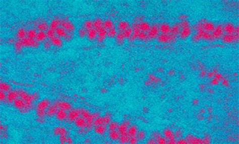 Prevention and control measures of Japanese encephalitis