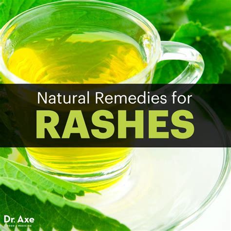 How To Get Rid Of A Rash 6 Natural Rash Remedies Natural Rash