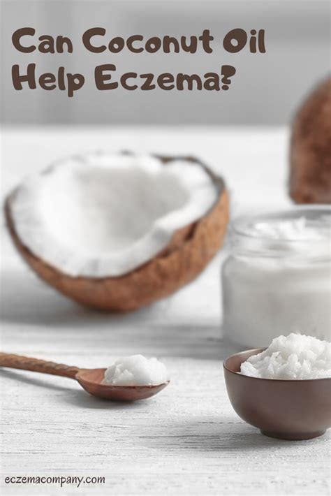 Can Coconut Oil Help Eczema Coconut Oil For Eczema Coconut Oil Uses
