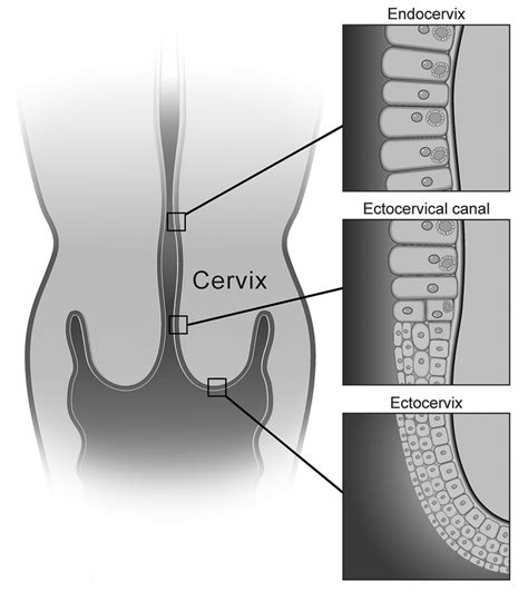 Multimodality Imaging Of Uterine Cervical Malignancies AJR