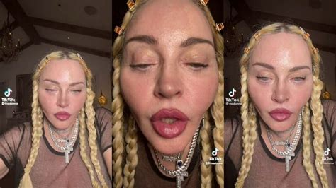 What Happened To Madonna Viral Tiktok Video Sparks Concern Online