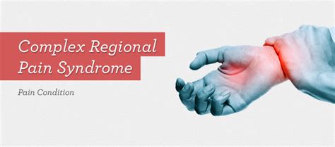 Complex Regional Pain Syndrome Complete Spine And Pain Care