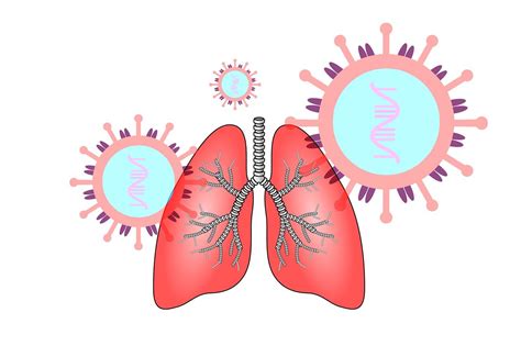 Virus ini dapat melemahkan dan membuat saluran udara bronkial menjadi iritasi sehingga mengakibatkan bronkitis kronis. Waspada, Ini Tanda Kalau Paru-Paru Kita Sedang Tidak Sehat ...