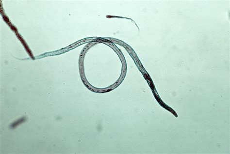 Overview Of Roundworms In Dogs