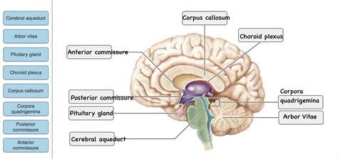 Solved Please Help Reset Cerebral Aqueducd Corpora Quadrigemina