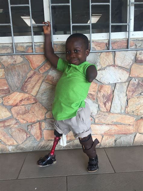 Little Legs Turn Blessings Life Around Legs4africa