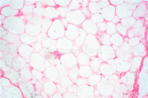 Human Fat Body Tissue Under Microscope View Stock Image Image Of Care