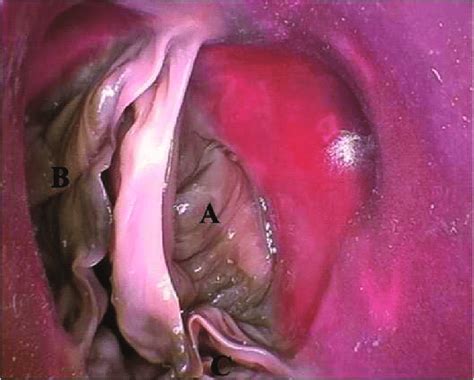Fotografía de modelo anatómico de corazón plastinado en posición