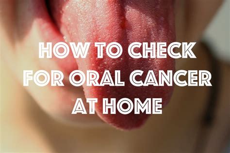 How To Check For Mouth Cancer At Home Healthproadvice