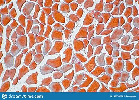 The bone of the shaft of a long bone is a thick layer of compact bone. Cross Section Muscle Skeleton Micro Preparation Samples ...
