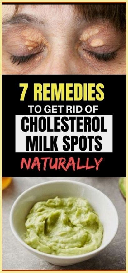 7 Remedies To Get Rid Of Cholesterol Milk Spots Naturally Cholesterol