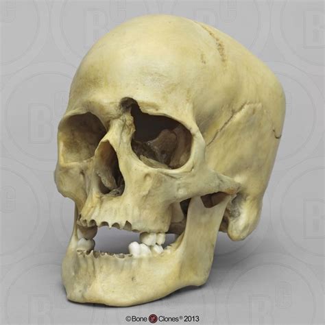 Forensic Skulls Bone Clones Inc Osteological Reproductions Skull And Bones Human Skull