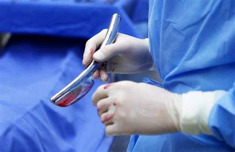 Autopsias Proceso Clave Para Conocer Enfermedades Gaceta Udg