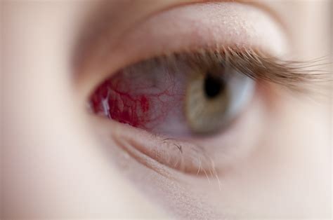 ‎skratch lets you keep track of all the places you've been and create a personalized world map of your travel memories. scratch on eye - pictures, photos