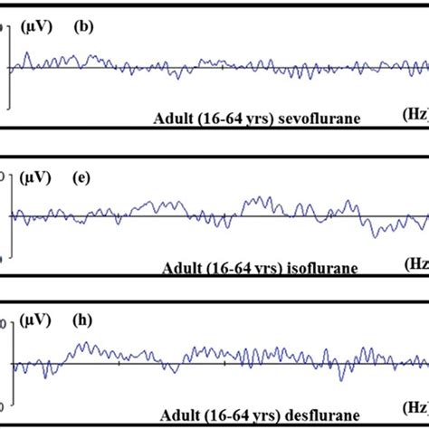 The Bispectral Index Bis Monitor Is An Electroencephalographic Eeg