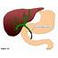 Liver Transplantation And Endoscopic Management Of Bile Duct 