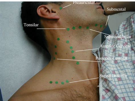 Pin On EcografÍa De Cuello