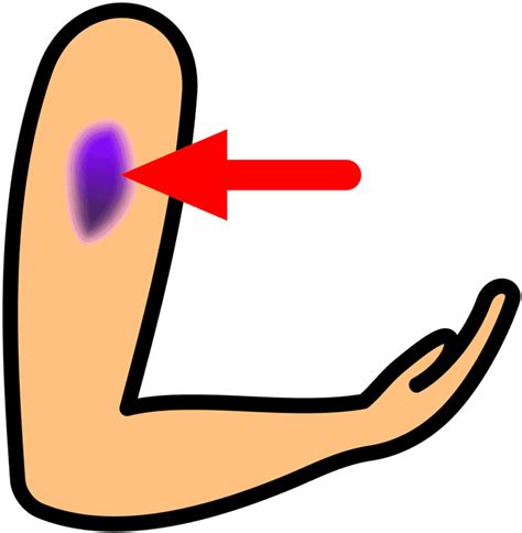 100 Bruise Png Images