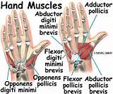 Intrinsic Hand Muscle Exercises Photos