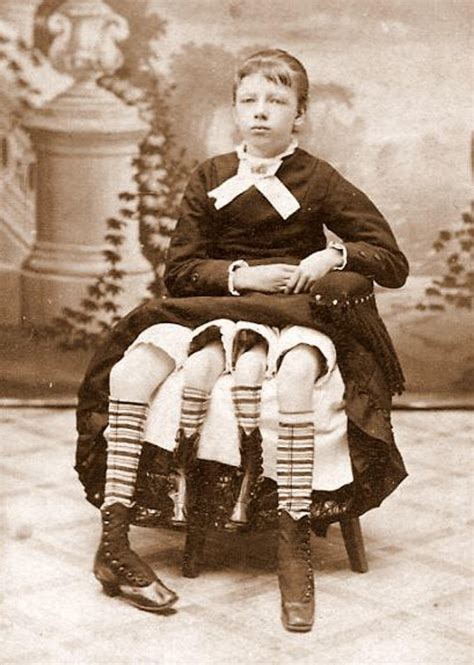 Josephine myrtle corbin is the woman with 4 legs. Kai ši mergina pastojo, visi gydytojai buvo šokiruoti tikrosios tiesos apie jos vaikus ...