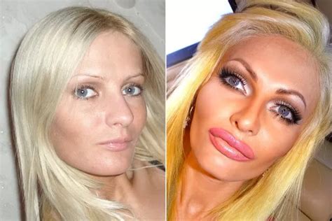 Glamour Model Spends 30k On Plastic Surgery To Look Like A Blow Up SEX