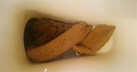 Do those stools look normal? My Daily Poo: 22 Mar: Saturday plumes.