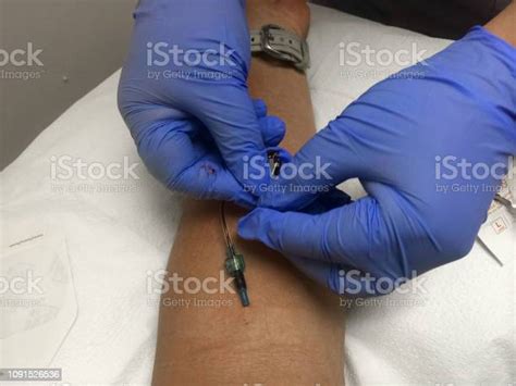 Blood Draw From A Picc Line How To Insert Stock Photo Download Image