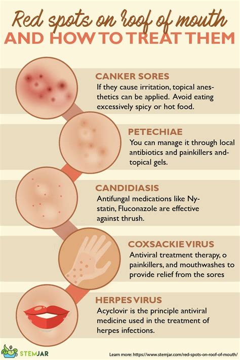 Red Spots On Roof Of Mouth What Are They And How To Treat Them Stemjar