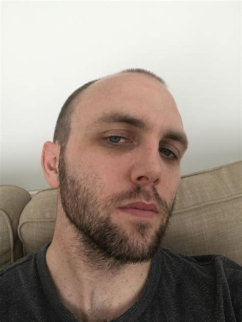 Almost 2 weeks in, should I start thinking about sorting the neck/cheek