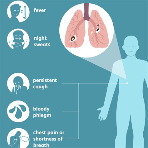 Tuberculosis Signs Symptoms And Complications