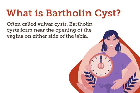 Bartholin S Cysts Treatment Causes Pictures Symptoms Popping My XXX