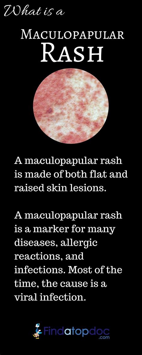 A Maculopapular Rash Is Made Of Both Flat And Raised Skin Lesions The
