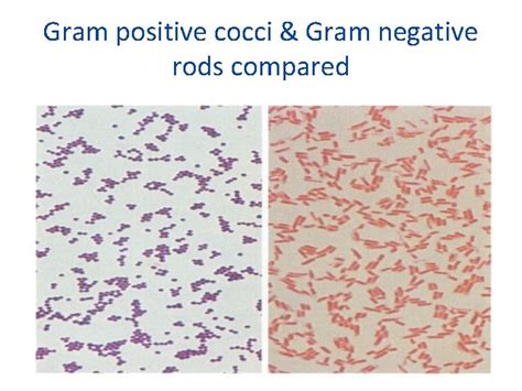 Gram Pos Cocci Staphylococci And Streptococci And Anaerobic