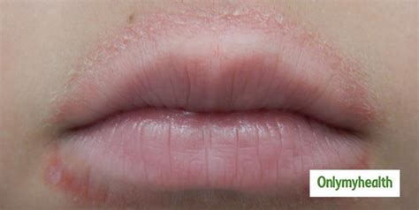 Skin Around Lips